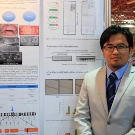 طبيب سعودي يقترب من حل أسرار بروتين نادر في الأسنان
