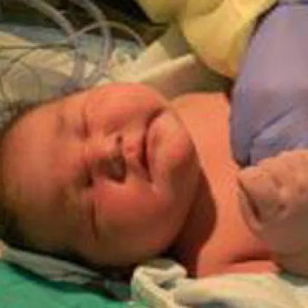 أمريكية تلد طفلاً وزنه "15" كيلوغراماً