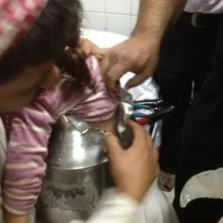 الدفاع المدني ينقذ طفلة سعودية علقت بإناء حليب