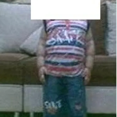 أصغر طفل في العالم يجري عملية تصغير للمعدة سعودي