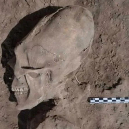 اكتشاف جثة برأس يشبه الفضائيين