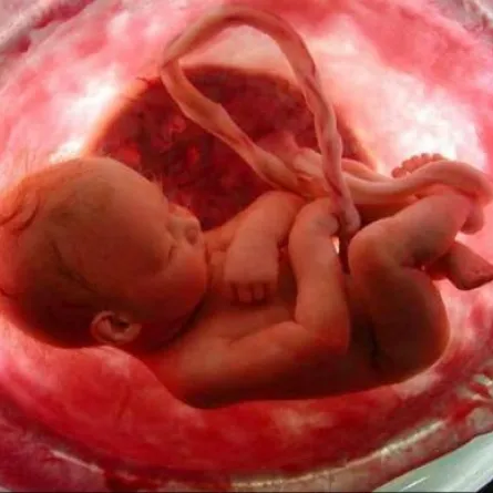 الأشعة فوق الصوتيَّة تؤثر في مخ الجنين وعينيه