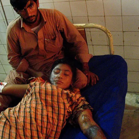 ممثلة باكستانية تحرق بالأسيد وتصاب بتشوهات دائمة