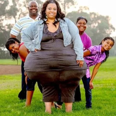 أمريكية تدخل موسوعة غينيس عن أسوأ قوام في العالم