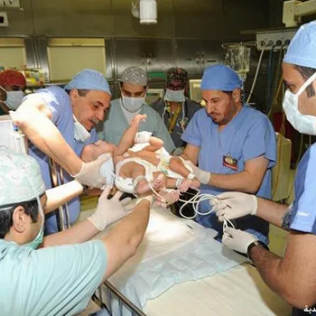 نقل التوأمين السياميين إلى مدينة الملك فهد الطبية