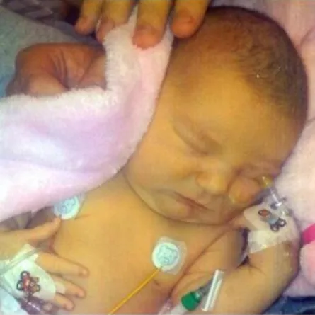 مولودة تعيش بنصف قلب