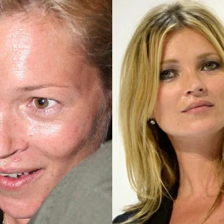 كايت موس كارثة جماليّة من دون فوتوشوب!