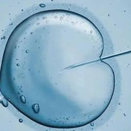 "سعوديات" يتحدين سن اليأس بالإخصاب الخارجي