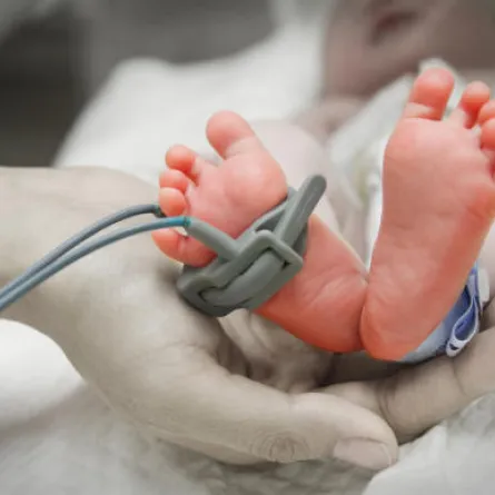 للكشف المبكر عن مرض الخلع الوركي