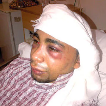 أب يتهم «أصدقاء» ابنه باختطافه وضربه في عجمان