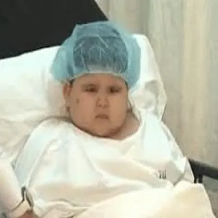 300 عملية تكميم معدة في السعودية