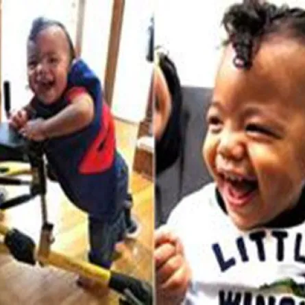 طفل أصم يسمع صوت أمه للمرة الأولى وينفجر ضاحكًا