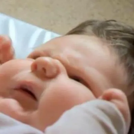 20 طبيب في ولادة الرضيع الأضخم في العالم