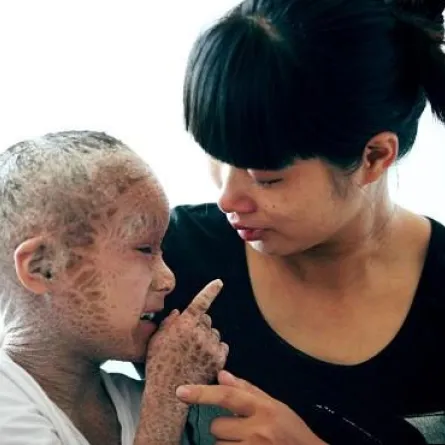 الطفل السمكة!