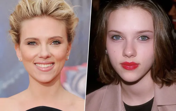 بالصور: 10نجمات قبل وبعد عمليات تجميل الأنف