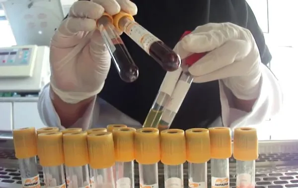 التسجيل ببرنامج سحب الدم لخريجات كليات العلوم حتى 10 يونيو