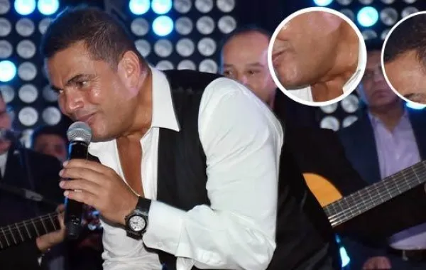عمرو دياب في صور تكشف ظهور تجاعيد على وجه فهل تصالح مع عمره؟