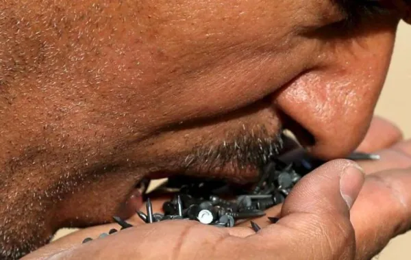 حالة نفسية تجعل رجلاً يبتلع 600 مسمار!
