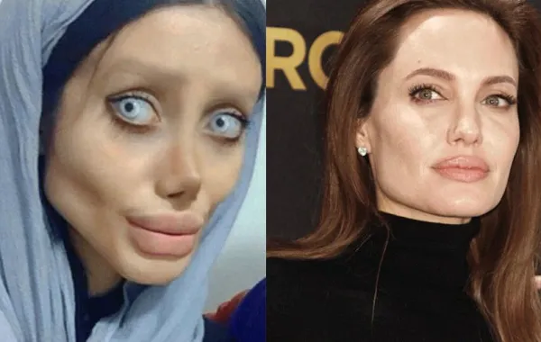 بالصور: إيرانية تتحول لـ نسخة "مخيفة" من أنجلينا جولي بعد 50 عملية تجميل