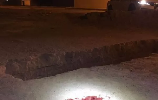 إصابة بالغة لطفل سقط داخل حفرة مكشوفة في شقراء