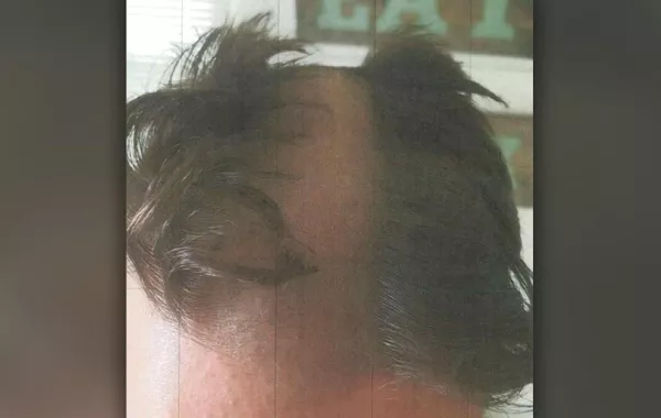 استدعى الشرطة لأن الحلاق حوَّله إلى مهرج!
