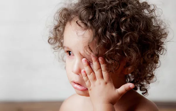 كيف نتعامل مع احمرار العين عند الأطفال؟