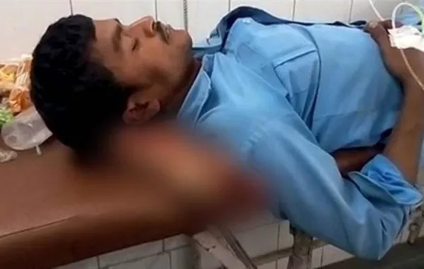 ساق مبتورة تتحول لـ«وسادة» في مستشفى حكومي بالهند