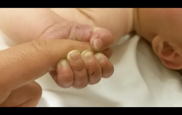 شاهد.. معجزة إلهية تنقذ رضيعًا بعد دفنه حيًا تسع ساعات