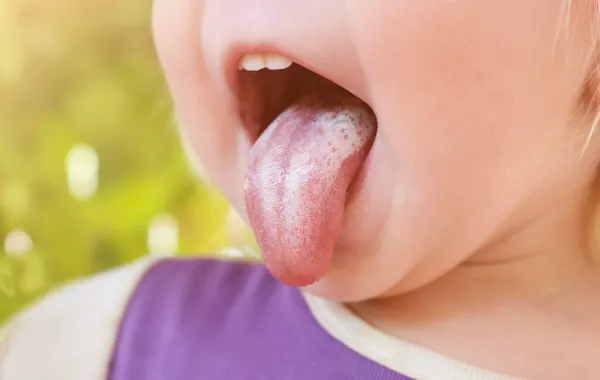 ما هي الكانديدا؟