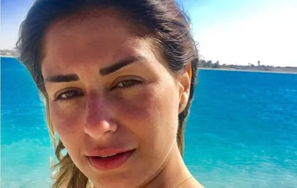 منة فضالي بدون ماكياج تماماً.. هل تغيرت ملامحها كثيراً بلا تجميل؟