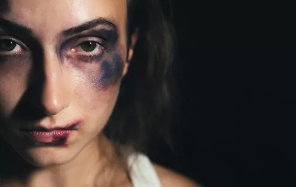 "أمل الحامد" توضح لـ"سيدتي" الآثار النفسية والصحية المترتبة على تعرُّض المرأة للعنف