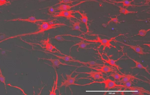 دراسة جديدة بجامعة نيويورك أبوظبي حول تكوين الخلايا العصبية