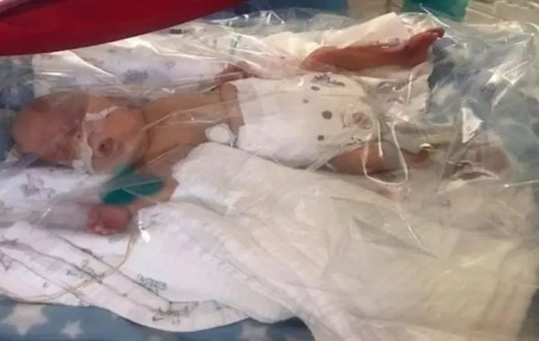 طفل بريطاني ولد بحجم حقنة يخالف توقعات الأطباء