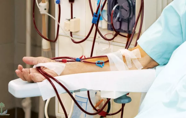نصائح لمرضى الغسيل الكلوي خلال شهر رمضان