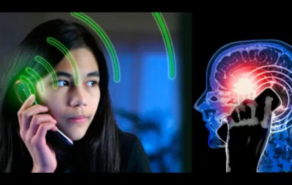 طفرات في جماجم الشباب... والسبب الهواتف المحمولة