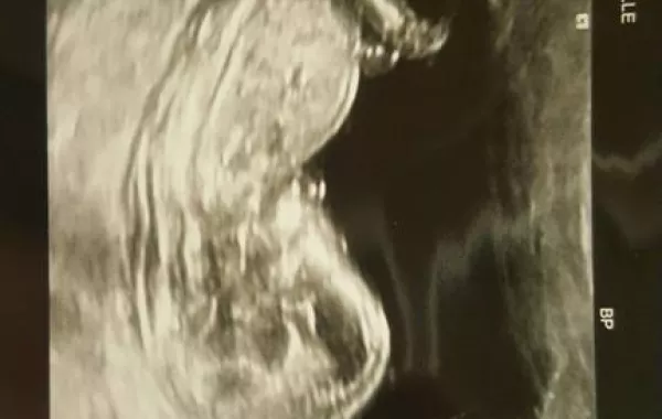 مقتل امرأة حامل بعدة طعنات.. والشرطة تنقذ رضيعها!