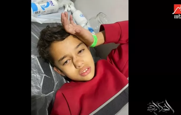 نجل أبو بعد تهشم أنفه - الصرة من برنامج الحكاية لعرو أديب - الصورة من قناة برنامج الحكاية على حسابها على يوتيوب 