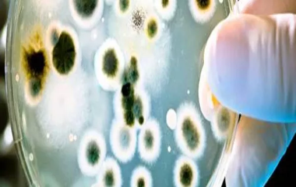 صورة لطبيب يفحص عدوى السالمونيلا