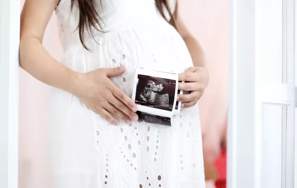 صورة لامرأة حامل تحمل أشعة موجات فوق الصوتية