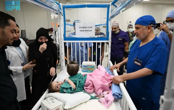 هذه العملية تُعد الرابعة لفصل توائم ملتصقة من سوريا