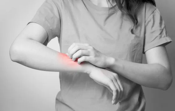 صورة لامرأة تشعر بالحكة