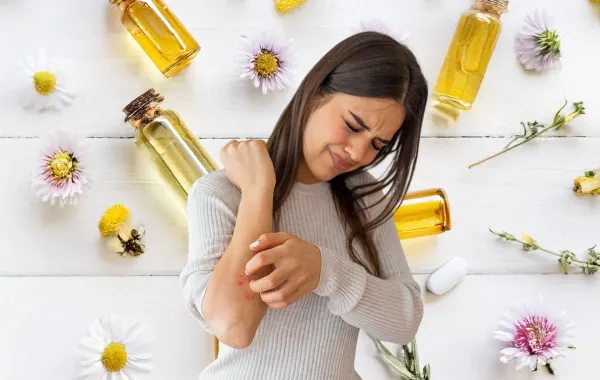 طرق تخفيف الأكزيما بمكوّنات منزلية