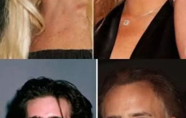 عمليات تجميل غيّرت ابتسامة هؤلاء النجوم