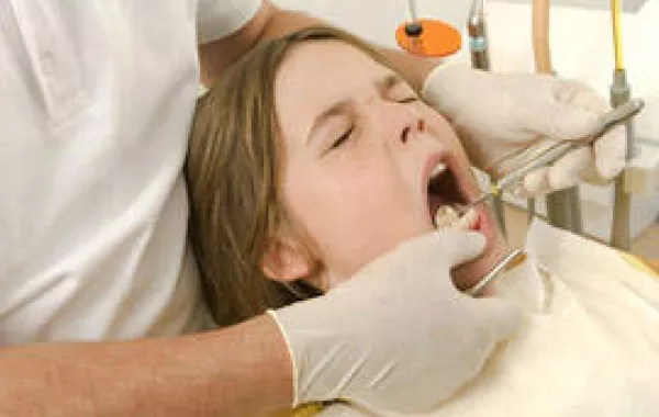 تسوس الأسنان يقلل فرص الإصابة بسرطان الفم والحلق