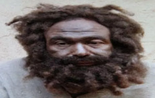 لماذا شوه خالد صالح وجهه؟