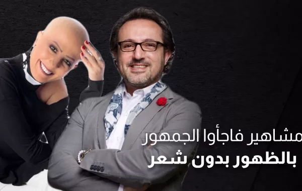 مشاهير فاجأوا الجمهور بالظهور بدون شعر